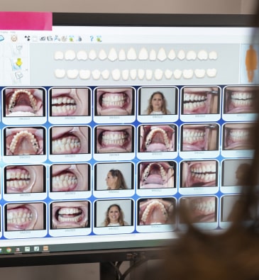 An Informative Screen Displaying Multiple Photos of Teeth